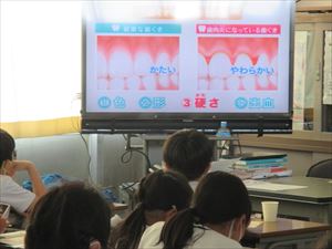 全国小学生歯みがき大会